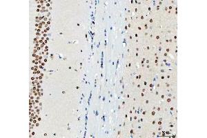 IHC analysis of DDX1 using anti-DDX1 antibody (ABIN7602052).