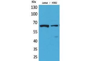Western Blot (WB) analysis of Jurkat, K562 cells using Acetyl-NFkappaB-p65 (K218) Polyclonal Antibody. (NF-kB p65 Antikörper  (acLys218))