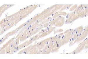Detection of IL18 in Rabbit Cardiac Muscle Tissue using Polyclonal Antibody to Interleukin 18 (IL18) (IL-18 Antikörper  (AA 32-192))