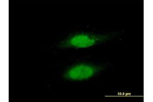 Immunofluorescence of purified MaxPab antibody to RAD23B on HeLa cell. (RAD23B Antikörper  (AA 1-409))