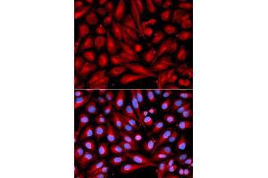 Immunofluorescence analysis of U2OS cells using MAP2K7 antibody (ABIN5971212). (MAP2K7 Antikörper)