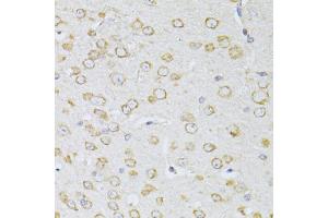Immunohistochemistry of paraffin-embedded mouse brain using NTS antibody (ABIN5998396) at dilution of 1/100 (40x lens). (Neurotensin Antikörper)