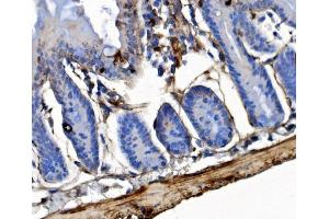 IHC analysis of Integrin Linked ILK using anti-Integrin Linked ILK antibody (ABIN7599411). (ILK Antikörper  (AA 1-452))