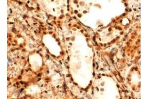 Antibody (2µg/ml) staining of paraffin embedded Human Thyroid Gland.