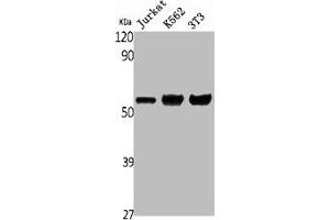 Western Blot analysis of Jurkat K562 NIH-3T3 cells using ENT1 Polyclonal Antibody (SLC29A1 Antikörper  (N-Term))