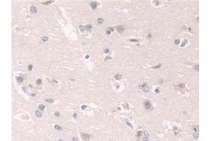 Immunohistochemistry (IHC) image for anti-FK506 Binding Protein 4, 59kDa (FKBP4) (AA 2-459) antibody (ABIN7441208)
