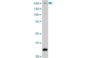 ARID1B monoclonal antibody (M02), clone 2F2 Western Blot analysis of ARID1B expression in Hela S3 NE . (ARID1B Antikörper  (AA 1364-1460))