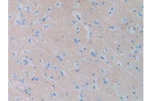 Figure. (SIRPA Antikörper  (AA 105-324))