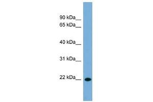 CD8B antibody used at 1 ug/ml to detect target protein. (CD8B Antikörper  (Middle Region))