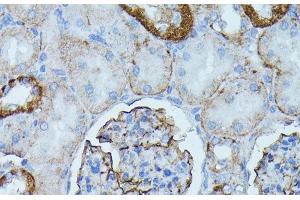 Immunohistochemistry of paraffin-embedded Rat kidney using PDE3A Polyclonal Antibody at dilution of 1:100 (40x lens). (PDE3A Antikörper)