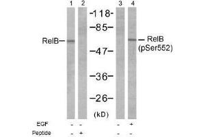 Image no. 1 for anti-V-Rel Reticuloendotheliosis Viral Oncogene Homolog B (RELB) (Ser552) antibody (ABIN197500)