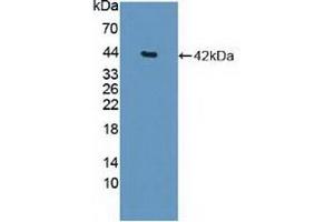 Detection of Recombinant HDAC9, Human using Polyclonal Antibody to Histone Deacetylase 9 (HDAC9) (HDAC9 Antikörper  (AA 23-343))
