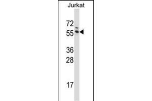 G3BP1 Antibody (C-term) (ABIN657707 and ABIN2846698) western blot analysis in Jurkat cell line lysates (35 μg/lane). (G3BP1 Antikörper  (C-Term))
