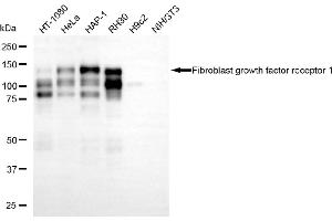 Western blotting analysis using fibroblast growth factor receptor 1 antibody (ABIN7798608). (Rekombinanter FGFR1 Antikörper)