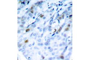 Immunohistochemistry (IHC) image for anti-Cyclin-Dependent Kinase 1 (CDK1) (pThr161) antibody (ABIN6225511) (CDK1 Antikörper  (pThr161))