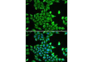 Immunofluorescence analysis of MCF-7 cells using PSMA6 antibody. (PSMA6 Antikörper)