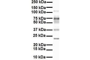 WB Suggested Anti-SLC27A3 antibody Titration: 1 ug/mL Sample Type: Human MCF7 (SLC27A3 Antikörper  (Middle Region))