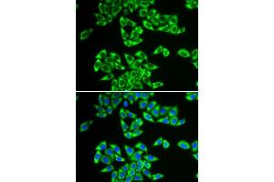 Immunofluorescence analysis of HeLa cells using DDX3X antibody. (DDX3X Antikörper  (AA 1-220))