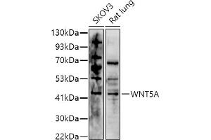 Western blot analysis of extracts of various cell lines, using (ABIN6134458, ABIN6150248, ABIN6150249 and ABIN6216485) at 1:1000 dilution. (WNT5A Antikörper  (AA 250-350))
