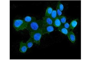 IF analysis of HSPH1 using anti-HSPH1 antibody (ABIN7602237). (HSPH1 Antikörper  (AA 653-858))