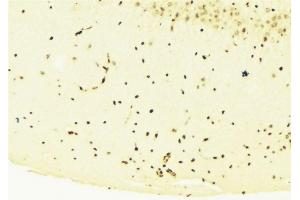 ABIN6276281 at 1/100 staining Mouse brain tissue by IHC-P. (STAT1 Antikörper  (C-Term))