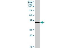 UNG MaxPab rabbit polyclonal antibody. (UNG Antikörper  (AA 1-304))