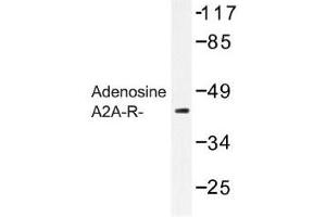Image no. 1 for anti-Adenosine A2a Receptor (ADORA2A) antibody (ABIN317694) (Adenosine A2a Receptor Antikörper)