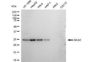 Western blotting analysis using BAG2 antibody (ABIN7797744).