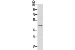 Gel: 8 % SDS-PAGE, Lysate: 60 μg, Lane: Raji cells, Primary antibody: ABIN7130829(RASSF7 Antibody) at dilution 1/800, Secondary antibody: Goat anti rabbit IgG at 1/8000 dilution, Exposure time: 5 seconds (RASSF7 Antikörper)
