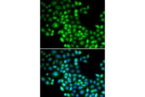 Immunofluorescence analysis of U2OS cells using FOXP1 antibody (ABIN5973033). (FOXP1 Antikörper)