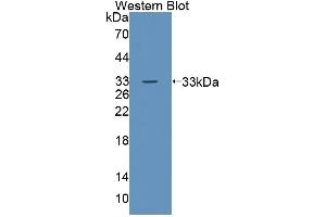 Detection of Recombinant TESK1, Human using Polyclonal Antibody to Testis Specific Kinase 1 (TESK1) (TSSK1 Antikörper  (AA 57-314))