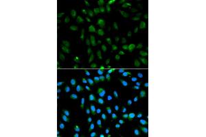 Immunofluorescence analysis of MCF-7 cells using PSMA3 antibody (ABIN5970587). (PSMA3 Antikörper)