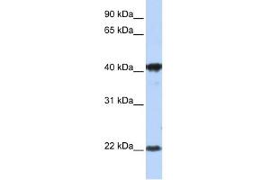 WB Suggested Anti-LIN7C Antibody Titration:  1 ug/ml  Positive Control:  MCF-7 whole cell lysates LIN7C is supported by BioGPS gene expression data to be expressed in MCF7 (LIN7C Antikörper  (Middle Region))
