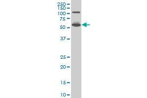 IRF5 monoclonal antibody (M05), clone 2D4 Western Blot analysis of IRF5 expression in A-431 . (IRF5 Antikörper  (AA 395-504))