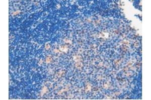 IHC-P analysis of Mouse Lymph Node Tissue, with DAB staining. (Involucrin Antikörper  (AA 301-460))
