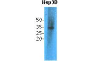 Image no. 1 for anti-Thiopurine S-Methyltransferase (TPMT) antibody (ABIN1490629) (TPMT Antikörper)