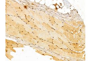ABIN7094233 and ABIN7098280 at 1/100 staining Rat skin tissue by IHC-P. (FHL2 Antikörper  (Internal Region))