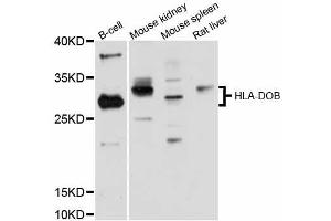 Western blot analysis of extracts of various cell lines, using HLA-DOB antibody (ABIN5997898) at 1:3000 dilution. (HLA-DOB Antikörper)