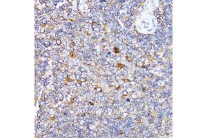 Immunohistochemistry (Paraffin-embedded Sections) (IHC (p)) image for anti-Toll Interacting Protein (TOLLIP) (AA 1-274) antibody (ABIN3023652)