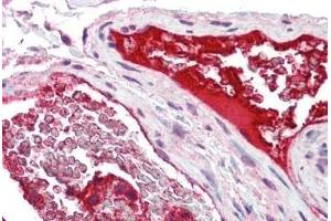 Immunohistochemistry (IHC) image for anti-C-Type Lectin Domain Family 7, Member A (CLEC7A) (AA 36-127) antibody (ABIN1804252)