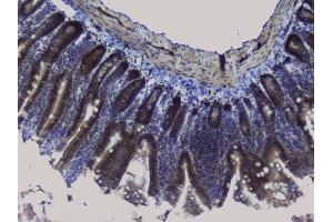 IHC analysis of NRF1 using anti-NRF1 antibody (ABIN6719347). (NRF1 Antikörper  (AA 246-503))