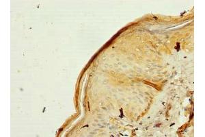 Immunohistochemistry of paraffin-embedded human skin tissue using ABIN7142443 at dilution of 1:100 (MRPL53 Antikörper  (AA 8-113))