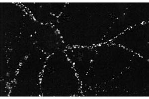 Immunofluorescence staining in dissociated hippocampal neurons with Psd monoclonal antibody, clone 6G6 . (PSD Antikörper)