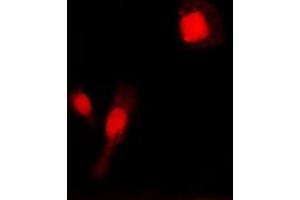 Immunofluorescent analysis of MMP2 staining in COLO205 cells. (MMP2 Antikörper  (C-Term))