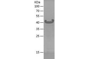 Western Blotting (WB) image for GNAS Complex Locus (GNAS) (AA 47-245) protein (His tag) (ABIN7282901) (GNAS Protein (AA 47-245) (His tag))