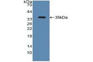 Detection of Recombinant ATF4, Human using Polyclonal Antibody to Activating Transcription Factor 4 (ATF4) (ATF4 Antikörper  (AA 130-347))