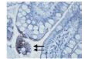 Image no. 1 for anti-Toll-Like Receptor 3 (TLR3) antibody (ABIN187555) (TLR3 Antikörper)