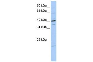 Western Blotting (WB) image for anti-Tubulin Polymerization-Promoting Protein Family Member 3 (TPPP3) antibody (ABIN2458655) (TPPP3 Antikörper)
