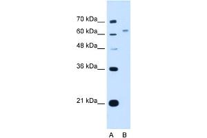 WB Suggested Anti-WSCD2 Antibody Titration:  1. (WSCD2 Antikörper  (C-Term))