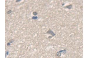 Immunohistochemistry (IHC) image for anti-N-Ethylmaleimide-Sensitive Factor (NSF) (AA 590-744) antibody (ABIN7440899)